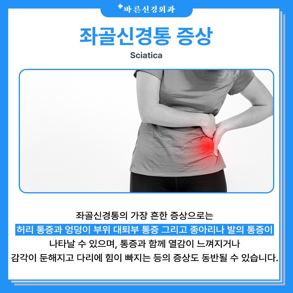 엉덩이부터 종아리까지 아픈 이유, 좌골신경통