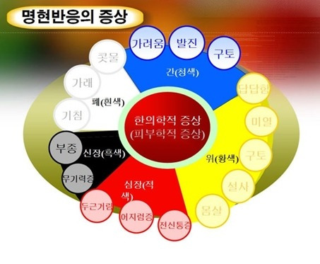 자발적 굶주림을 시작하다