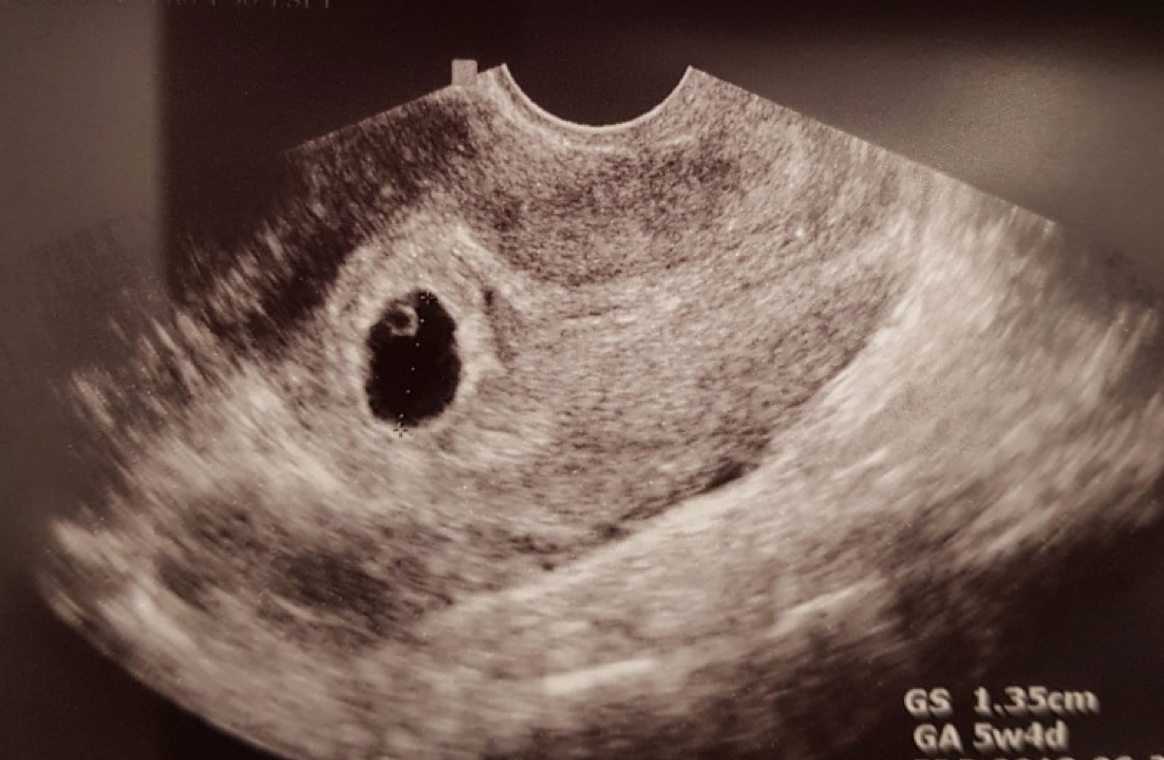 스크린샷 2017-10-26 오전 8.22.41.png