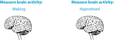 Hypnosis_brain1.png