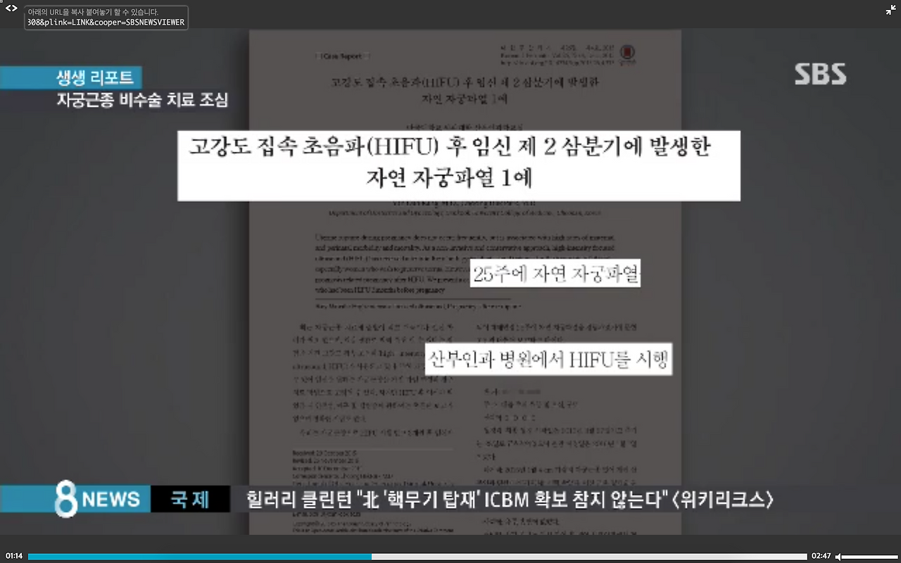 스크린샷 2017-03-09 오후 3.04.03.png