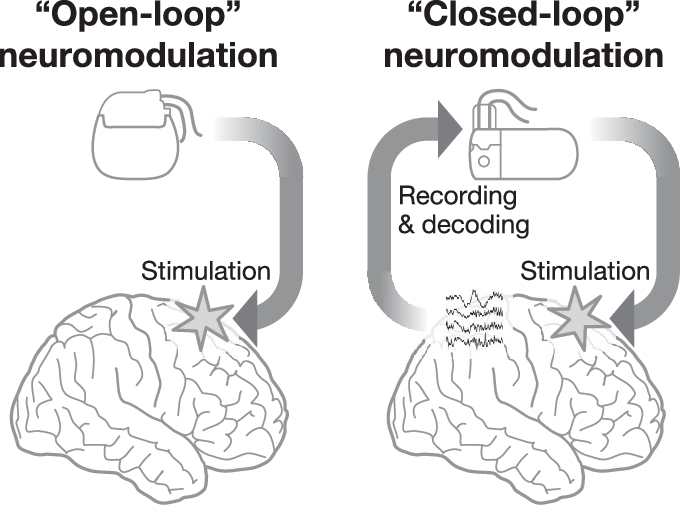 Open-loop-and-Closed-loop-Neuromodulation.png
