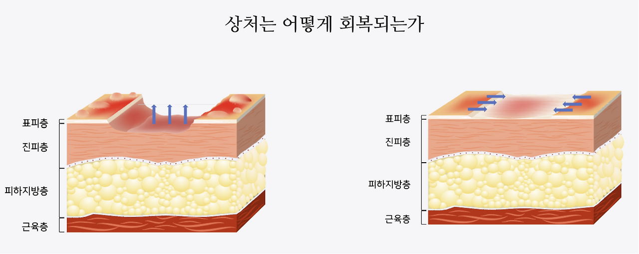 피부재생.png