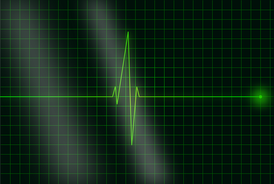 electrocardiogram-36732_960_720.png