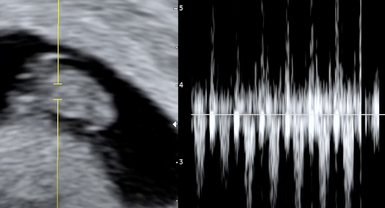 스크린샷 2025-01-20 오전 9.29.54.png