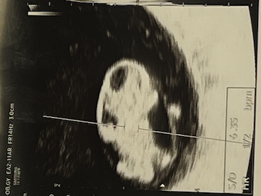 스크린샷 2025-07-08 오후 8.39.31.png