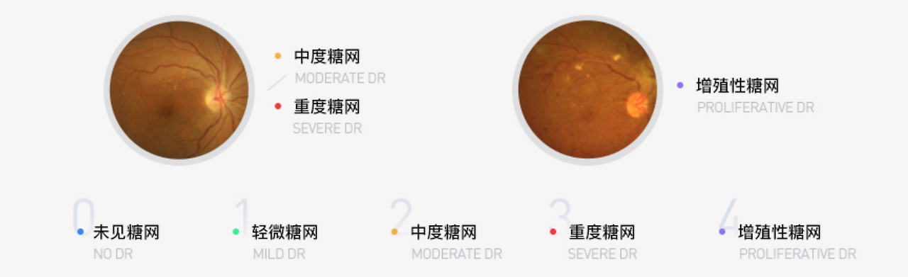 스크린샷 2017-12-06 오전 11.10.55.png