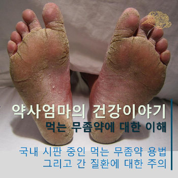 먹는무좀약에대한이해_약사엄마의건강이야기.png