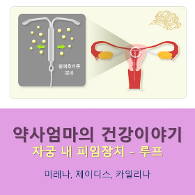 자궁내피임장치_루프_미레나_약사엄마의건강이야기.png