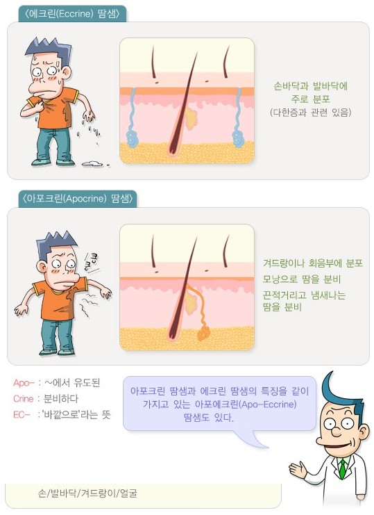 다한증2.png