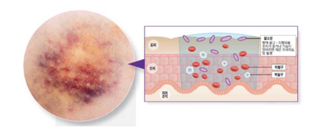스크린샷 2025-04-03 오후 10.02.51.png