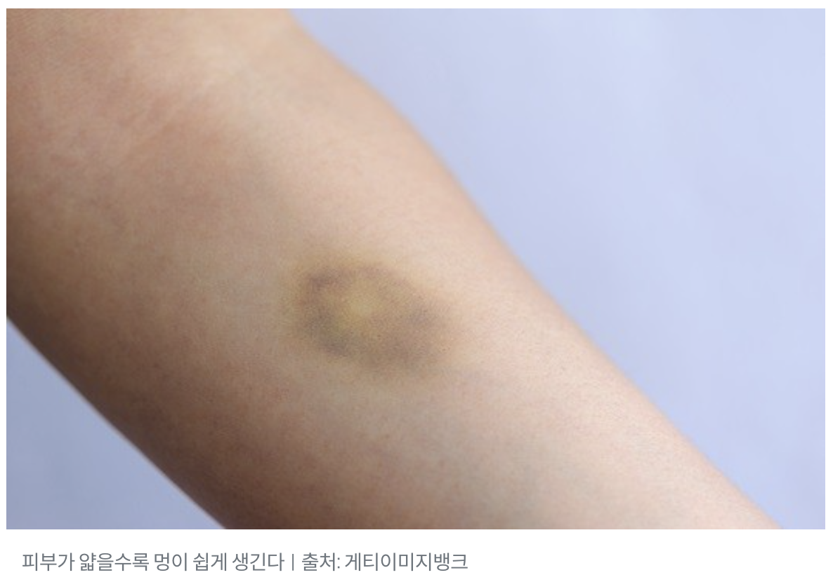 스크린샷 2025-04-03 오후 11.11.41.png