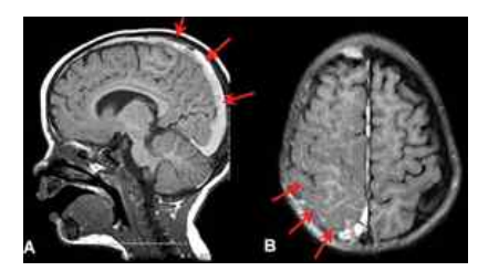 화면 캡처 2023-01-21 124311.png