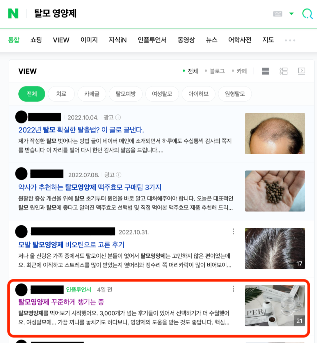 탈모 영양제 - 2위.png