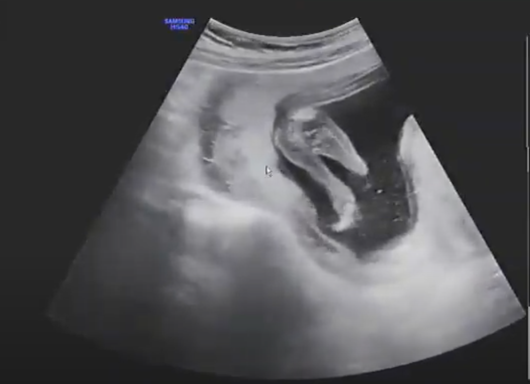 스크린샷 2021-03-02 오후 9.43.17.png