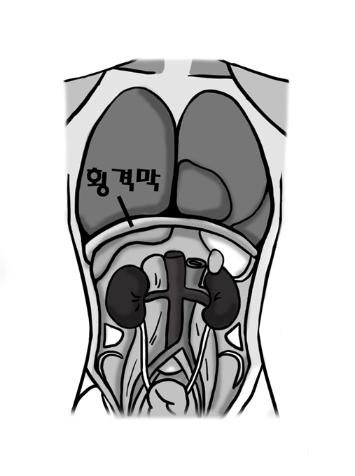 장기를제거하고 본모습01.png