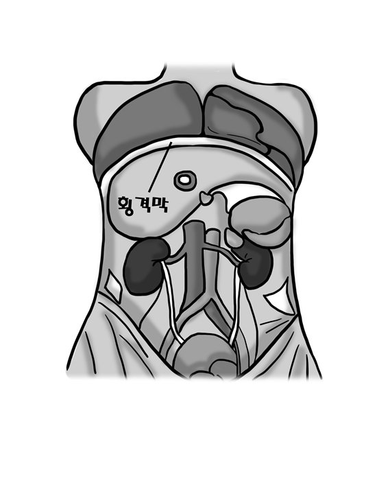 장기를 제거하고 아래에서 본모습01.png