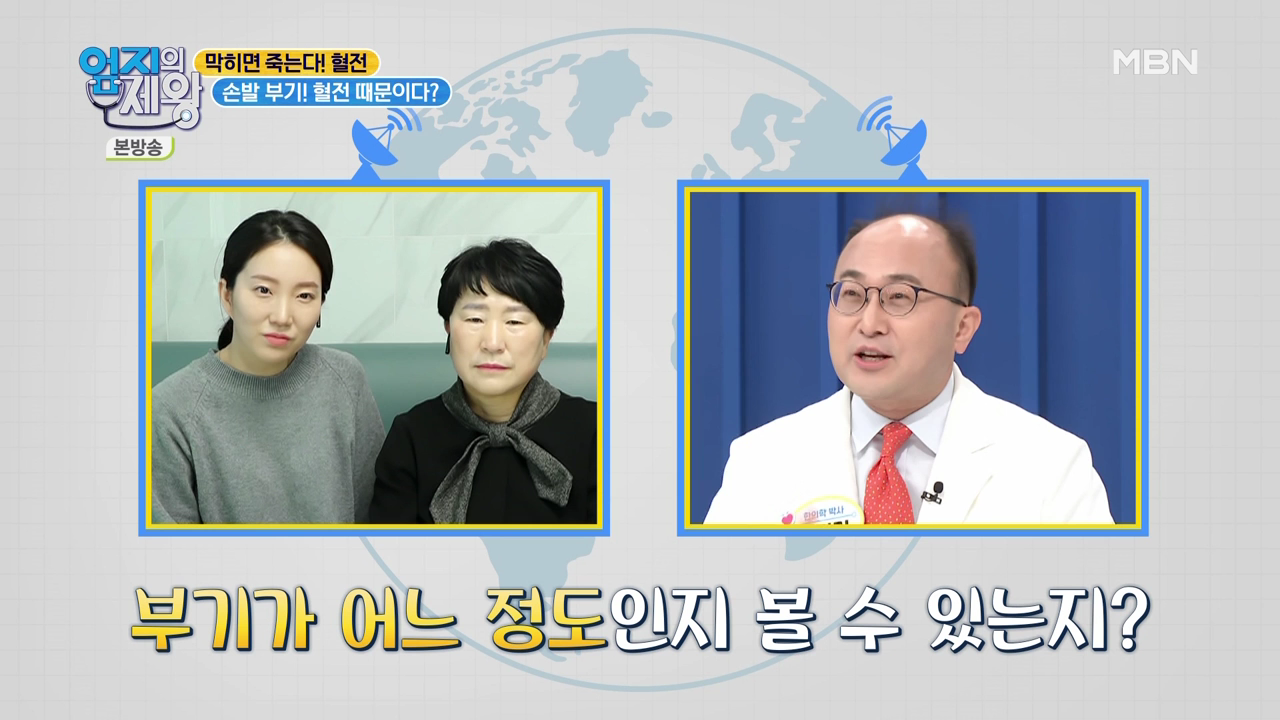 엄지의 제왕 415회 혈전편 본방영상.mp4_000436436.png