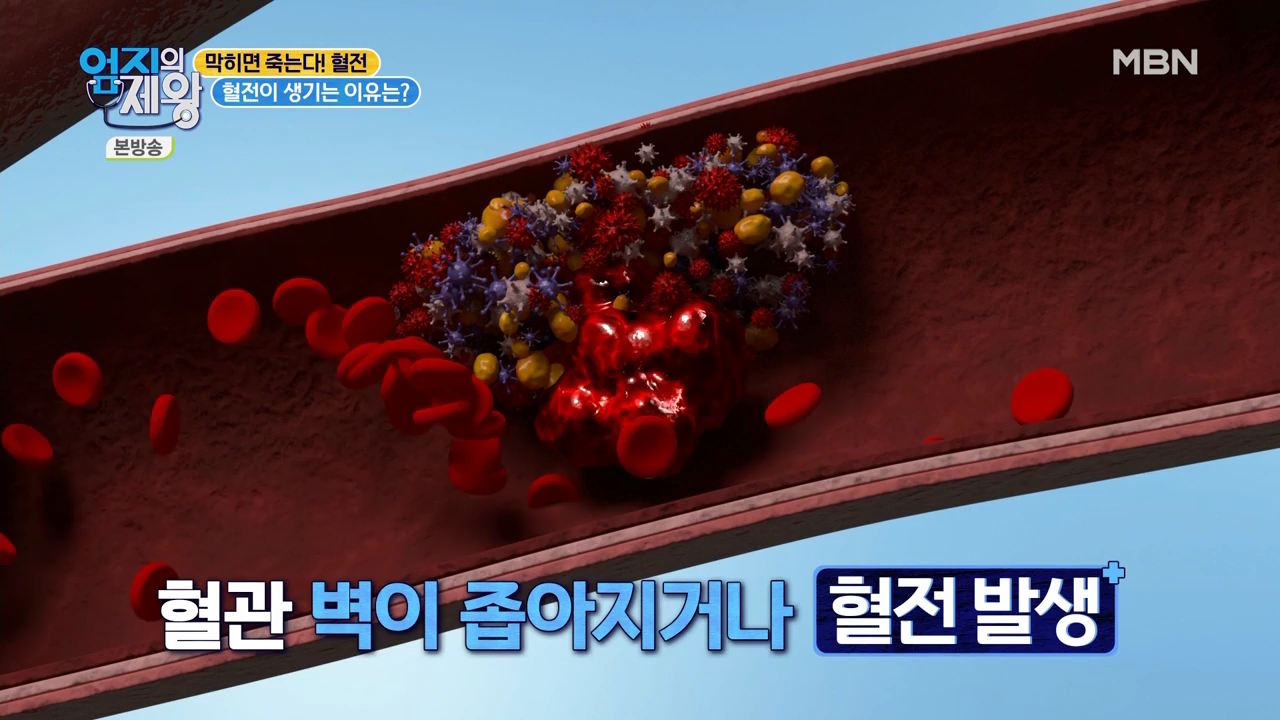 엄지의 제왕 415회 혈전편 본방영상.mp4_000214214.png