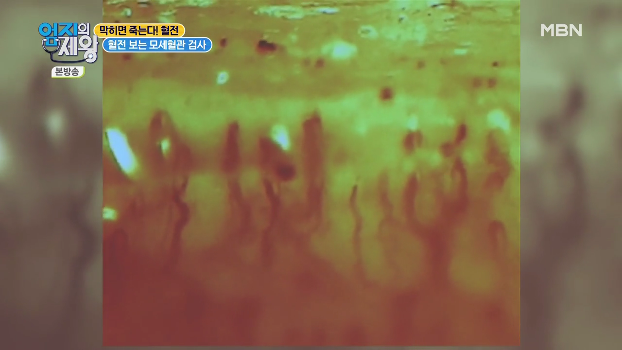 엄지의 제왕 415회 혈전편 본방영상.mp4_002523521.png