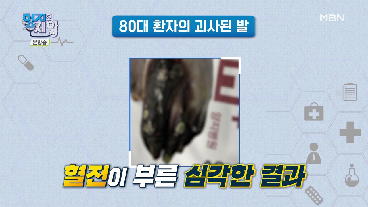 엄지의 제왕 415회 혈전편 본방영상.mp4_001496495.png