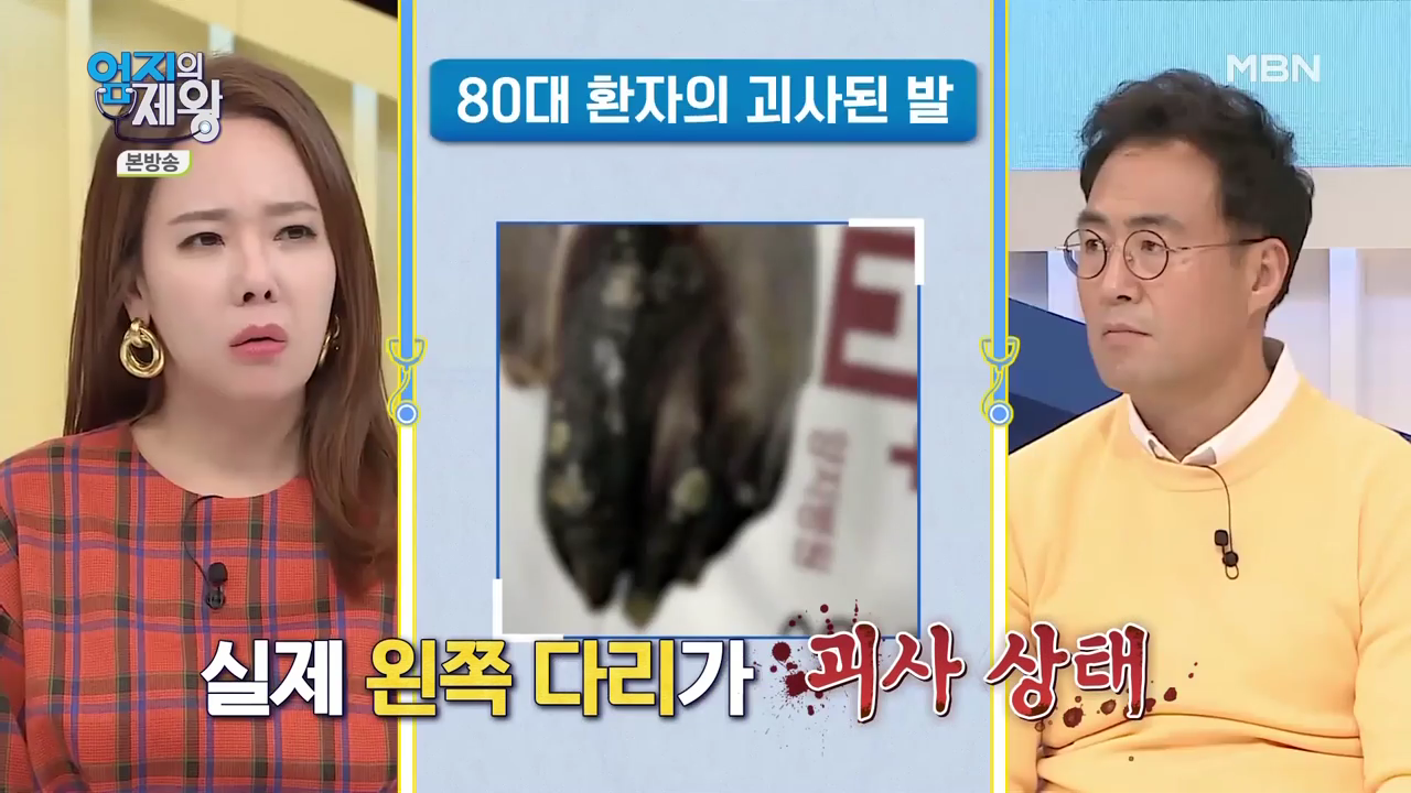 엄지의 제왕 415회 혈전편 본방영상.mp4_001478477.png