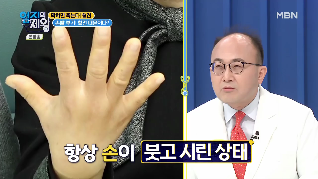 엄지의 제왕 415회 혈전편 본방영상.mp4_000442442.png