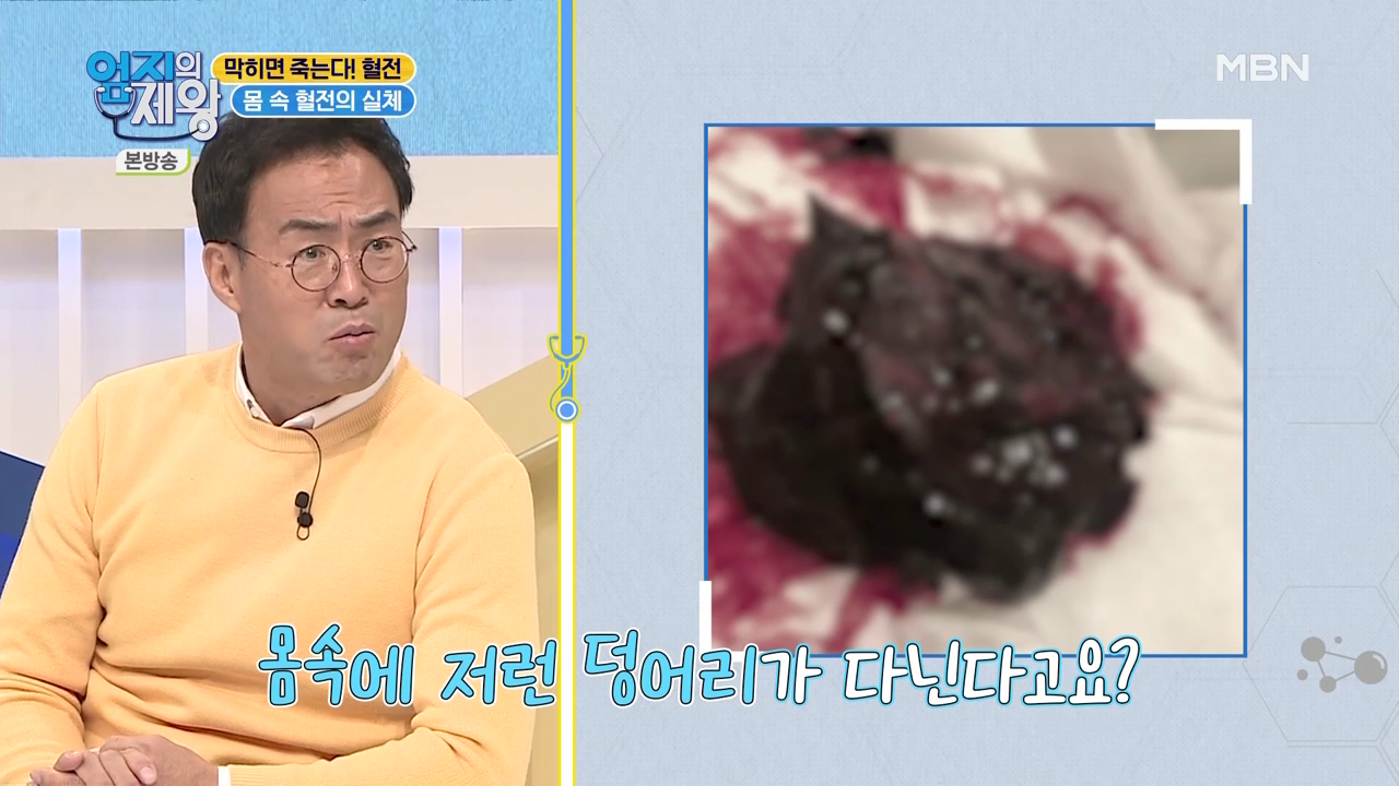 엄지의 제왕 415회 혈전편 본방영상.mp4_000169169.png