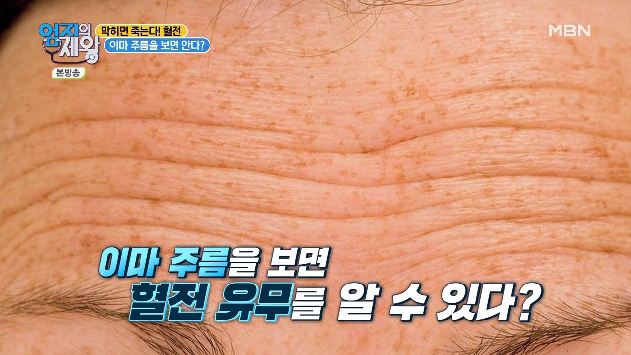 엄지의 제왕 415회 혈전편 본방영상.mp4_002007005.png