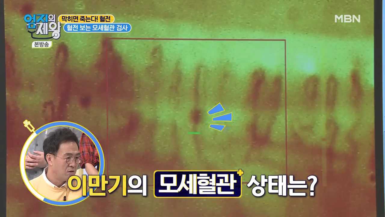 엄지의 제왕 415회 혈전편 본방영상.mp4_002562560.png