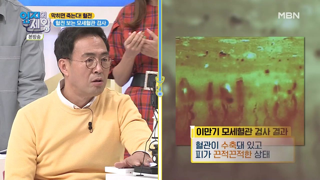 엄지의 제왕 415회 혈전편 본방영상.mp4_002586584.png