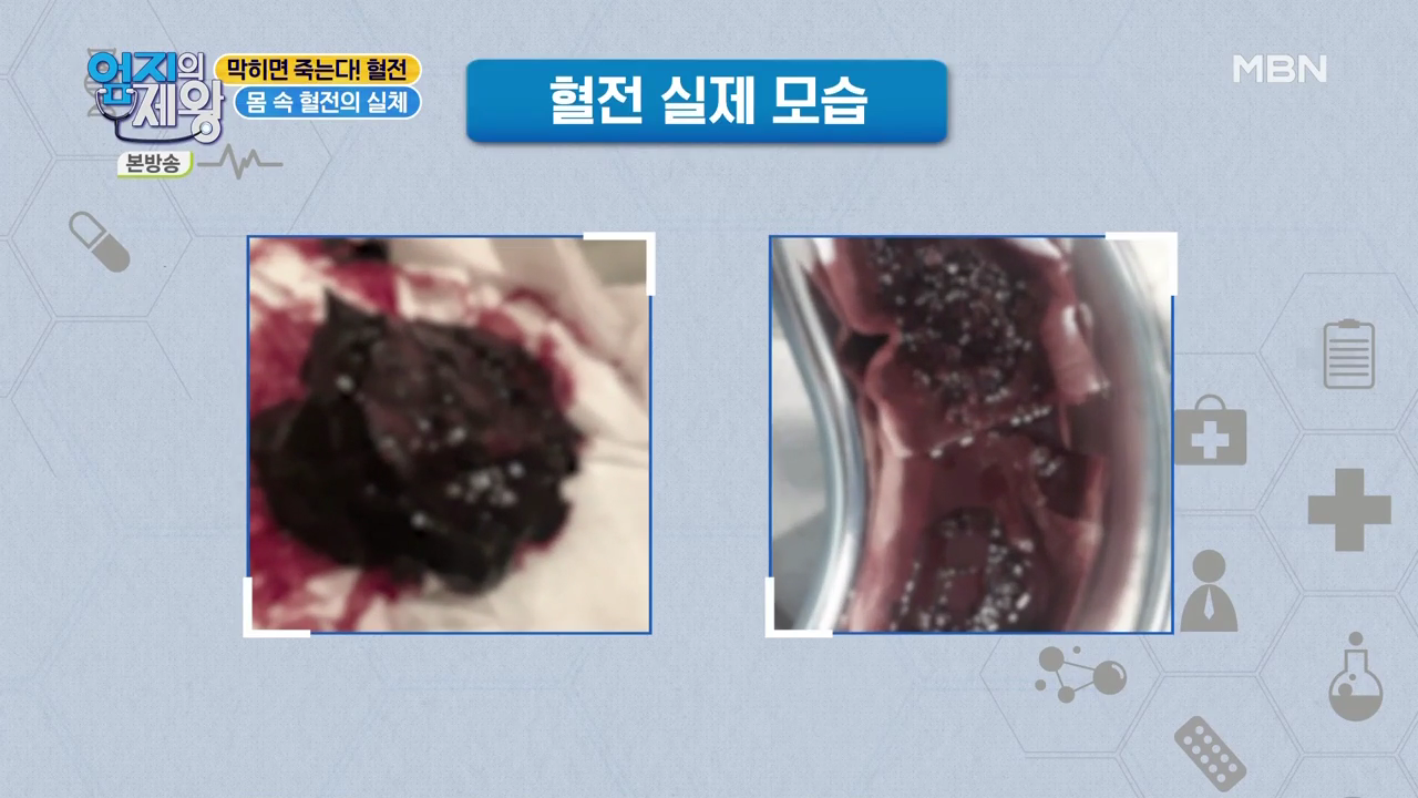 엄지의 제왕 415회 혈전편 본방영상.mp4_000163163.png