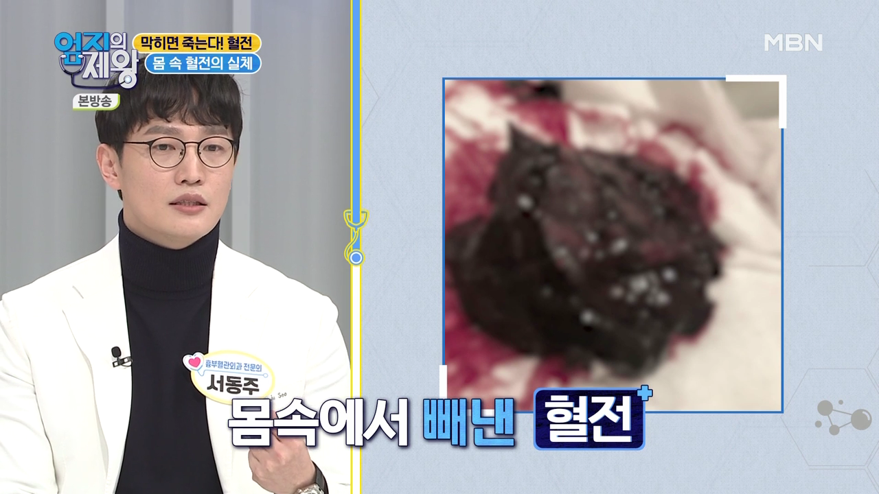 엄지의 제왕 415회 혈전편 본방영상.mp4_000175175.png