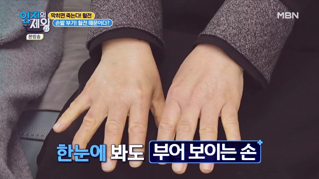 엄지의 제왕 415회 혈전편 본방영상.mp4_000448448.png