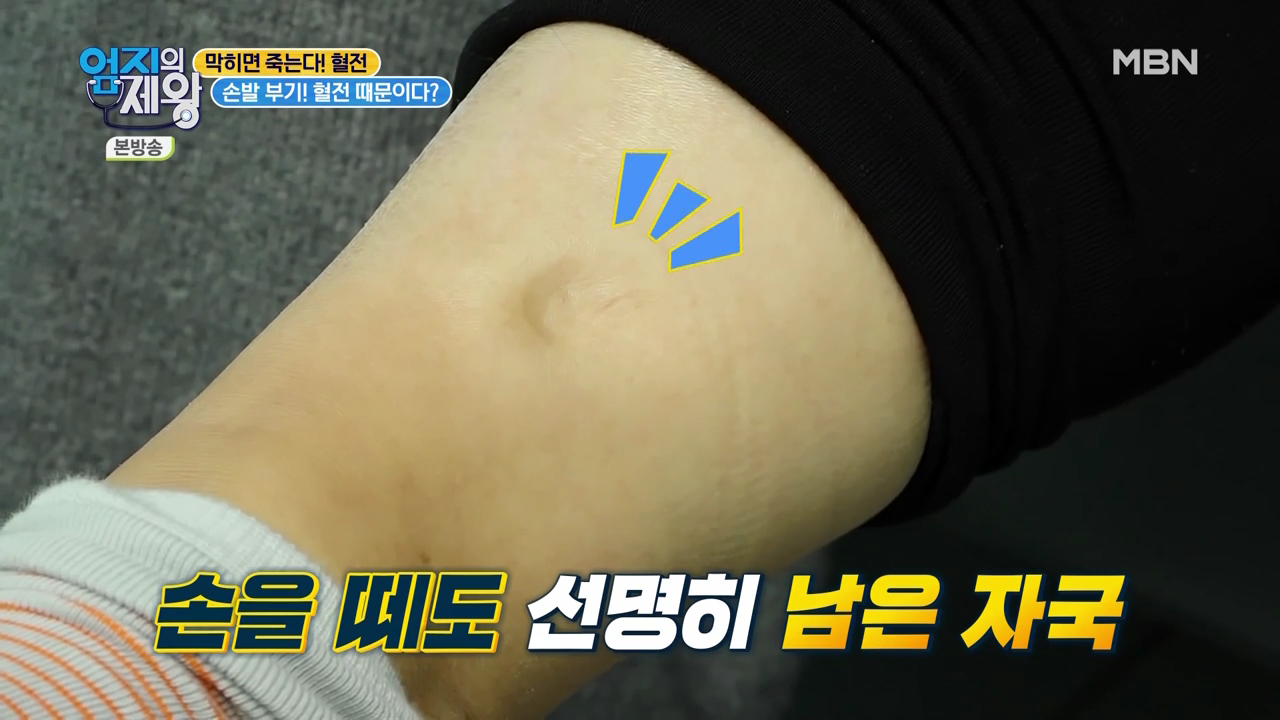 엄지의 제왕 415회 혈전편 본방영상.mp4_000463463.png