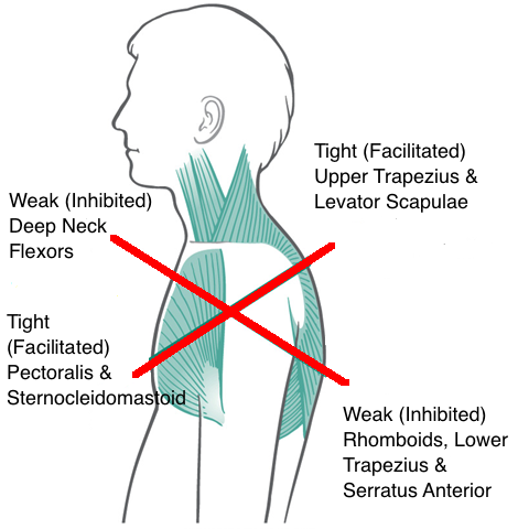 trapezius02.png