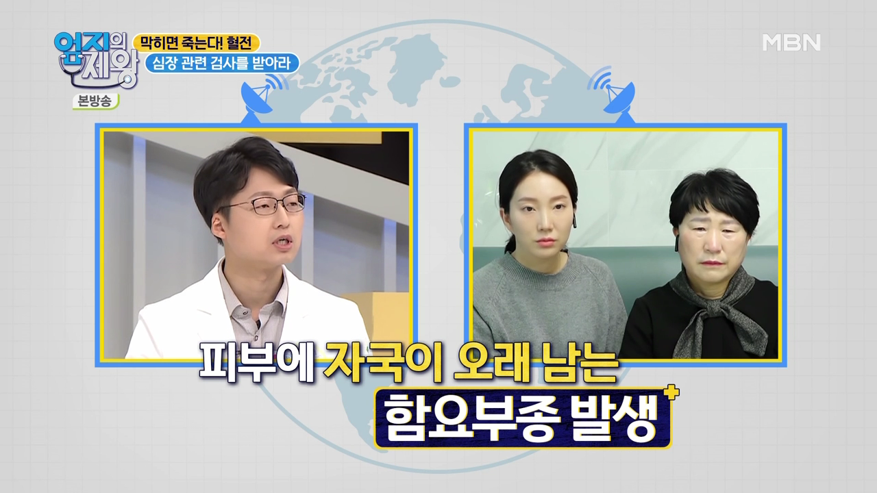 엄지의 제왕 415회 혈전편 본방영상.mp4_000739739.png