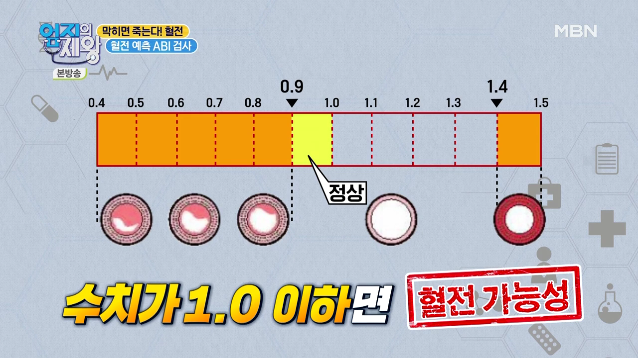 엄지의 제왕 415회 혈전편 본방영상.mp4_001460459.png