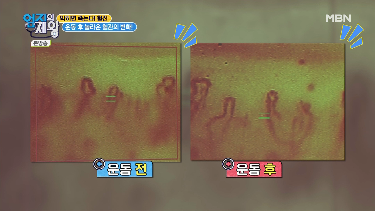 엄지의 제왕 415회 혈전편 본방영상.mp4_002952950.png