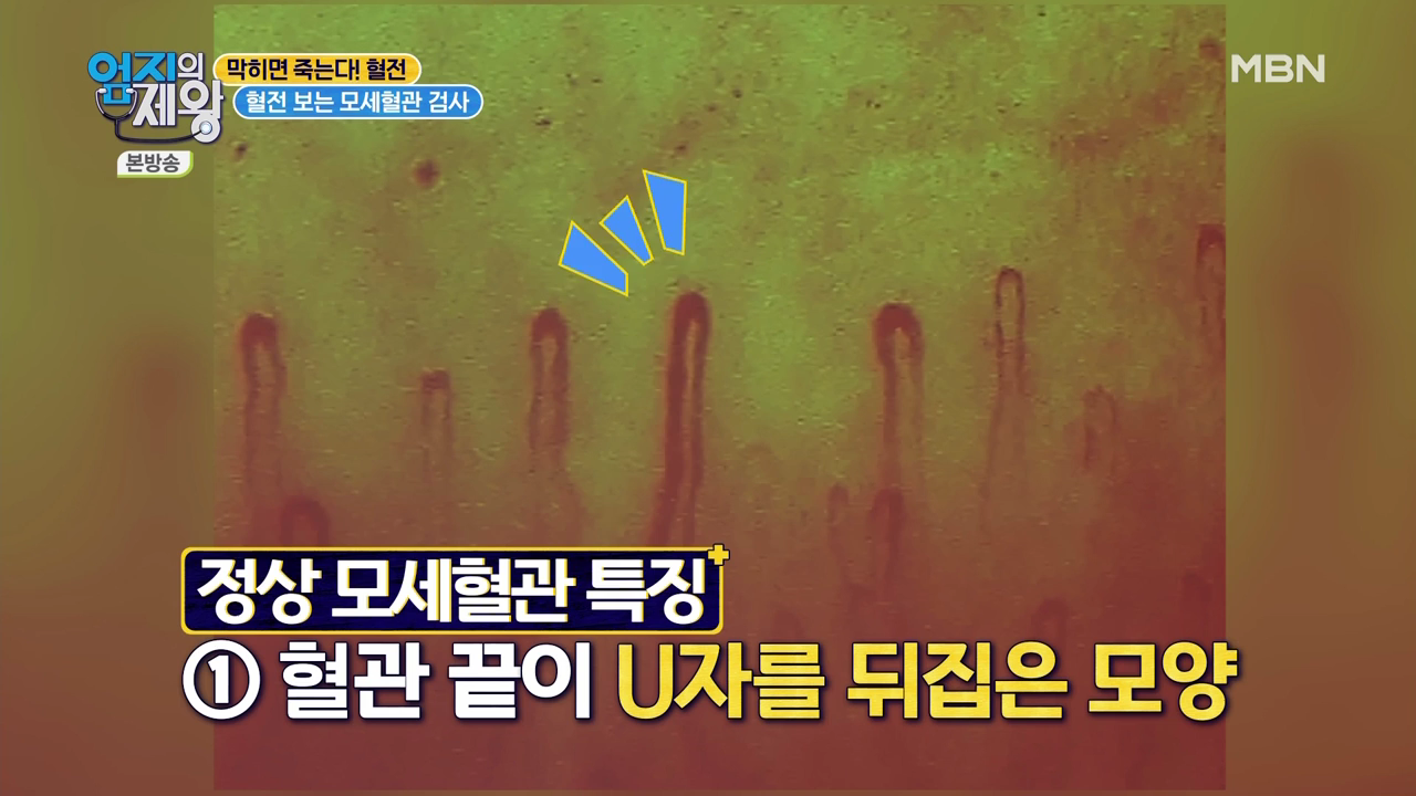 엄지의 제왕 415회 혈전편 본방영상.mp4_002460458.png