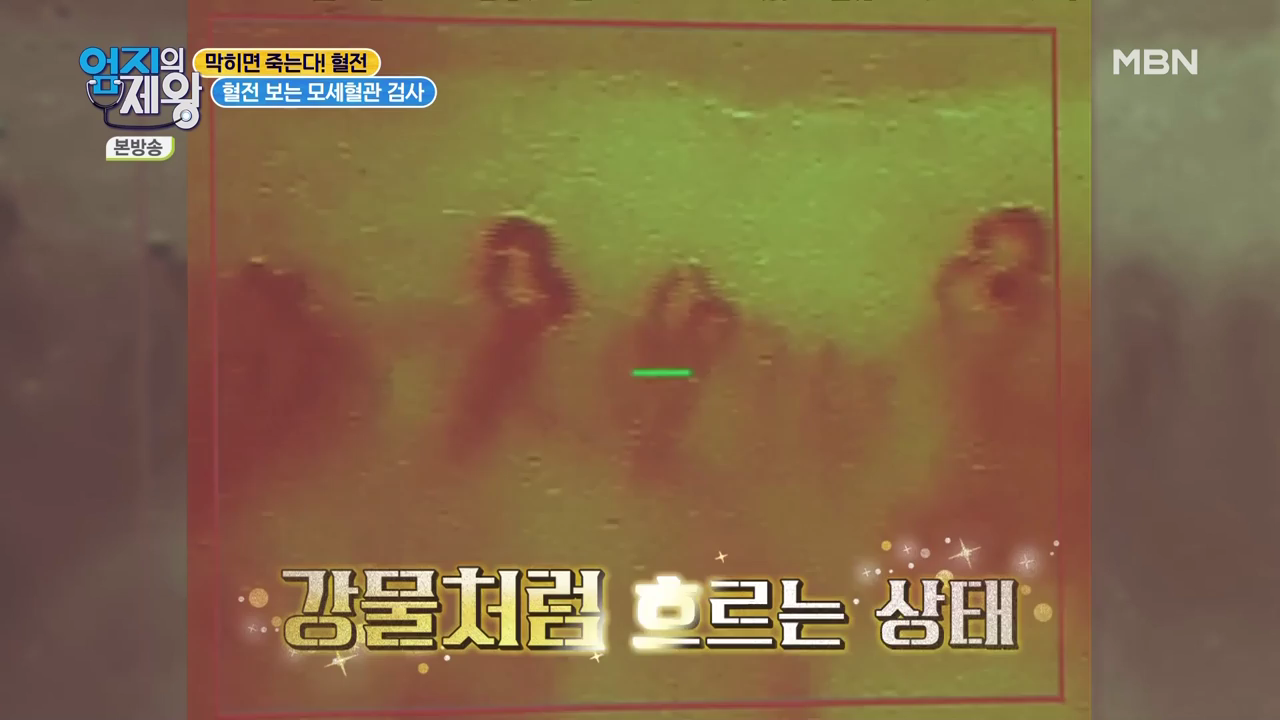엄지의 제왕 415회 혈전편 본방영상.mp4_002622620.png