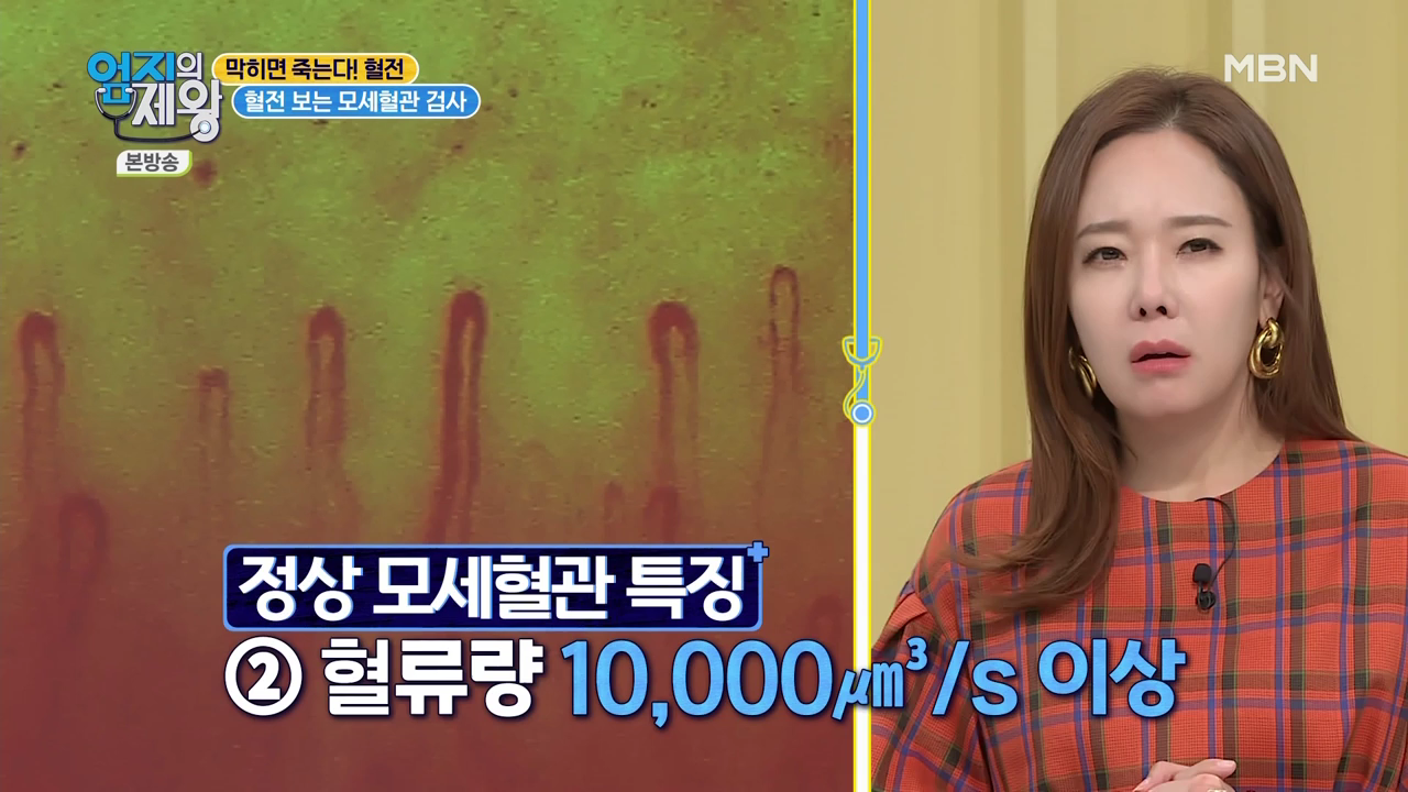 엄지의 제왕 415회 혈전편 본방영상.mp4_002466464.png