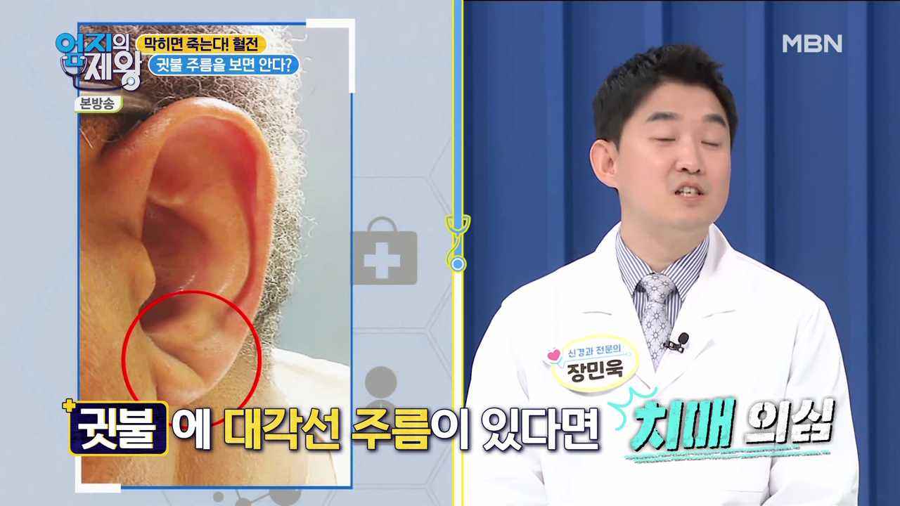 엄지의 제왕 415회 혈전편 본방영상.mp4_002073071.png