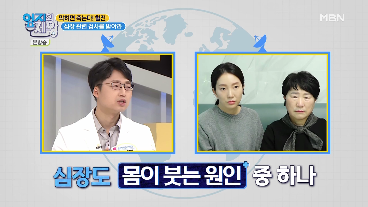 엄지의 제왕 415회 혈전편 본방영상.mp4_000718718.png