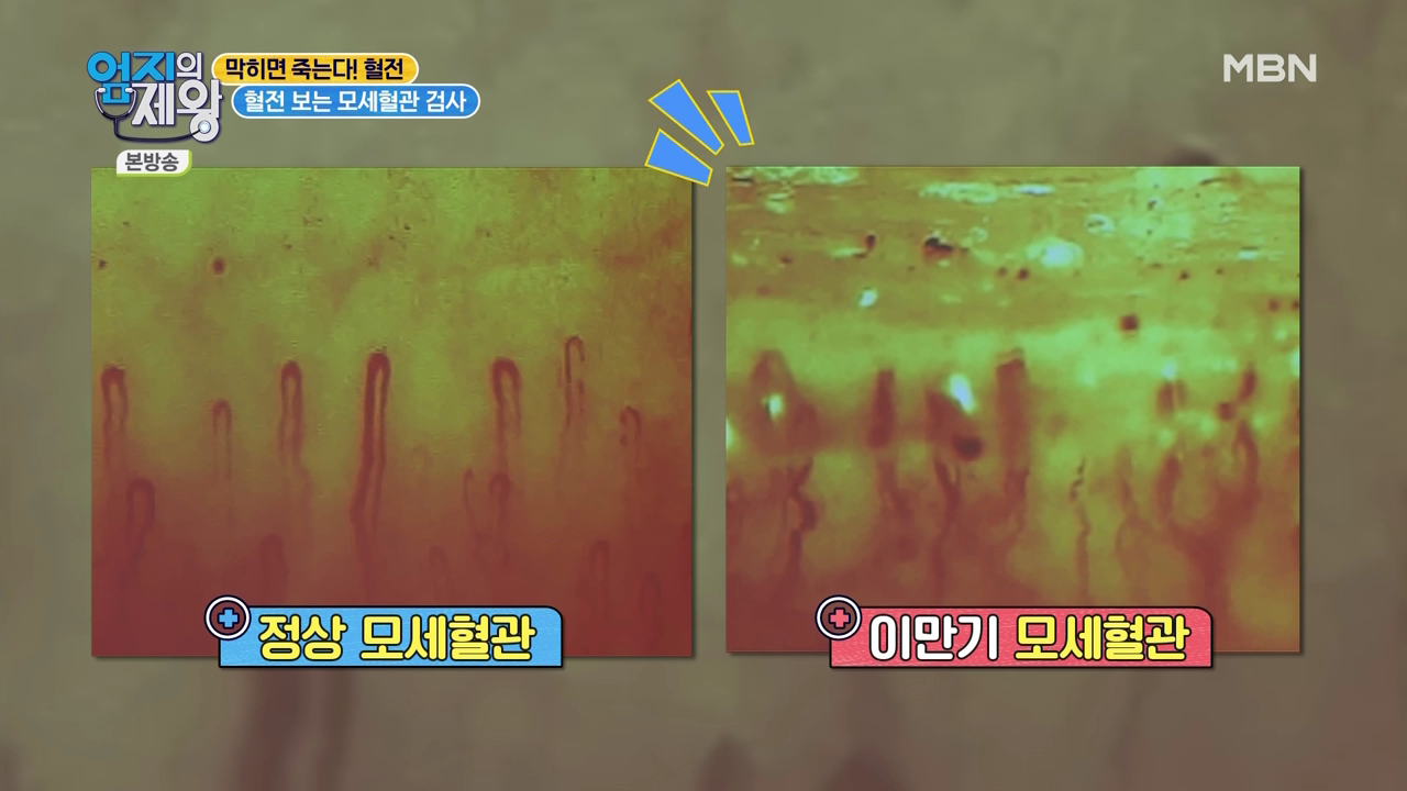 엄지의 제왕 415회 혈전편 본방영상.mp4_002541539.png