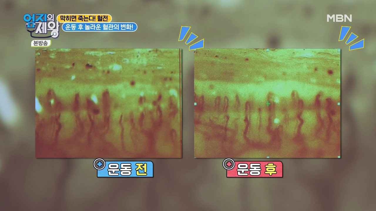 엄지의 제왕 415회 혈전편 본방영상.mp4_002904902.png