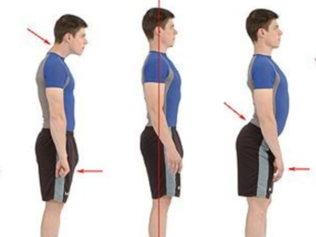 lumbarlordosis.png
