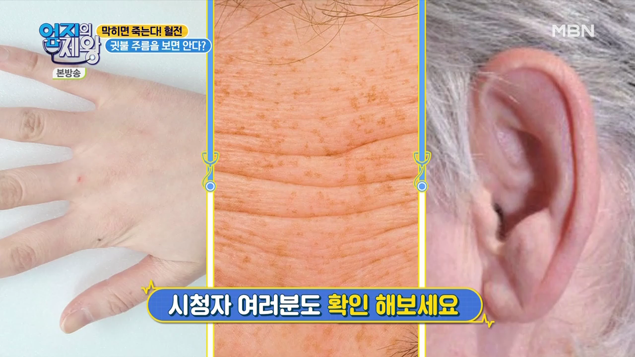 엄지의 제왕 415회 혈전편 본방영상.mp4_002118116.png