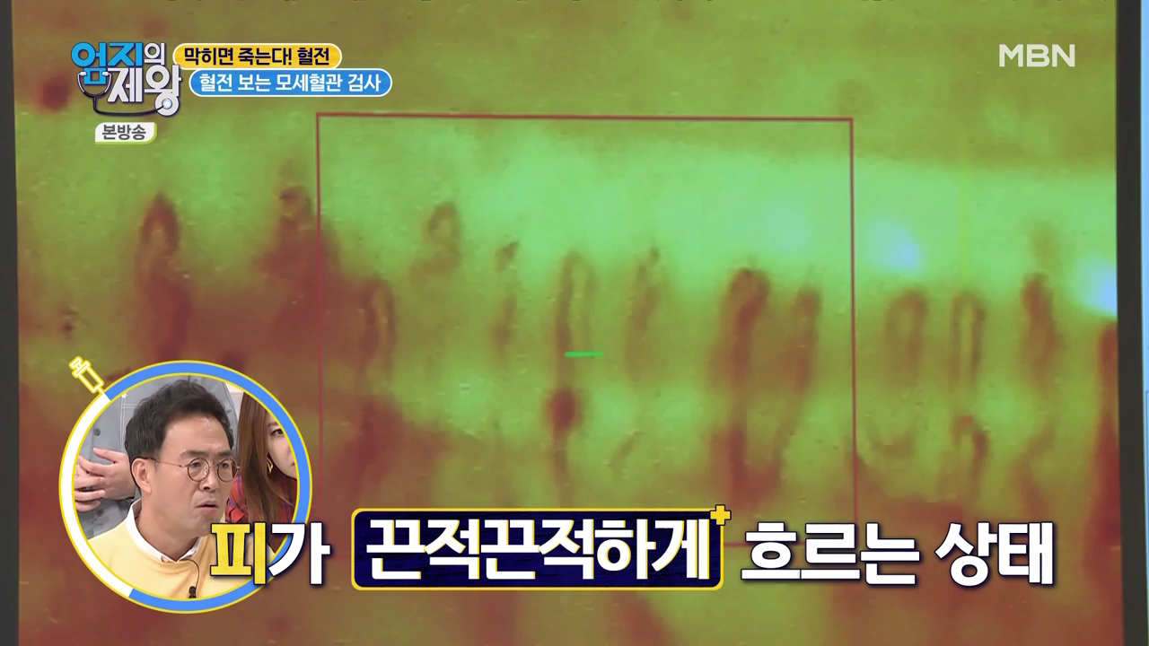 엄지의 제왕 415회 혈전편 본방영상.mp4_002574572.png