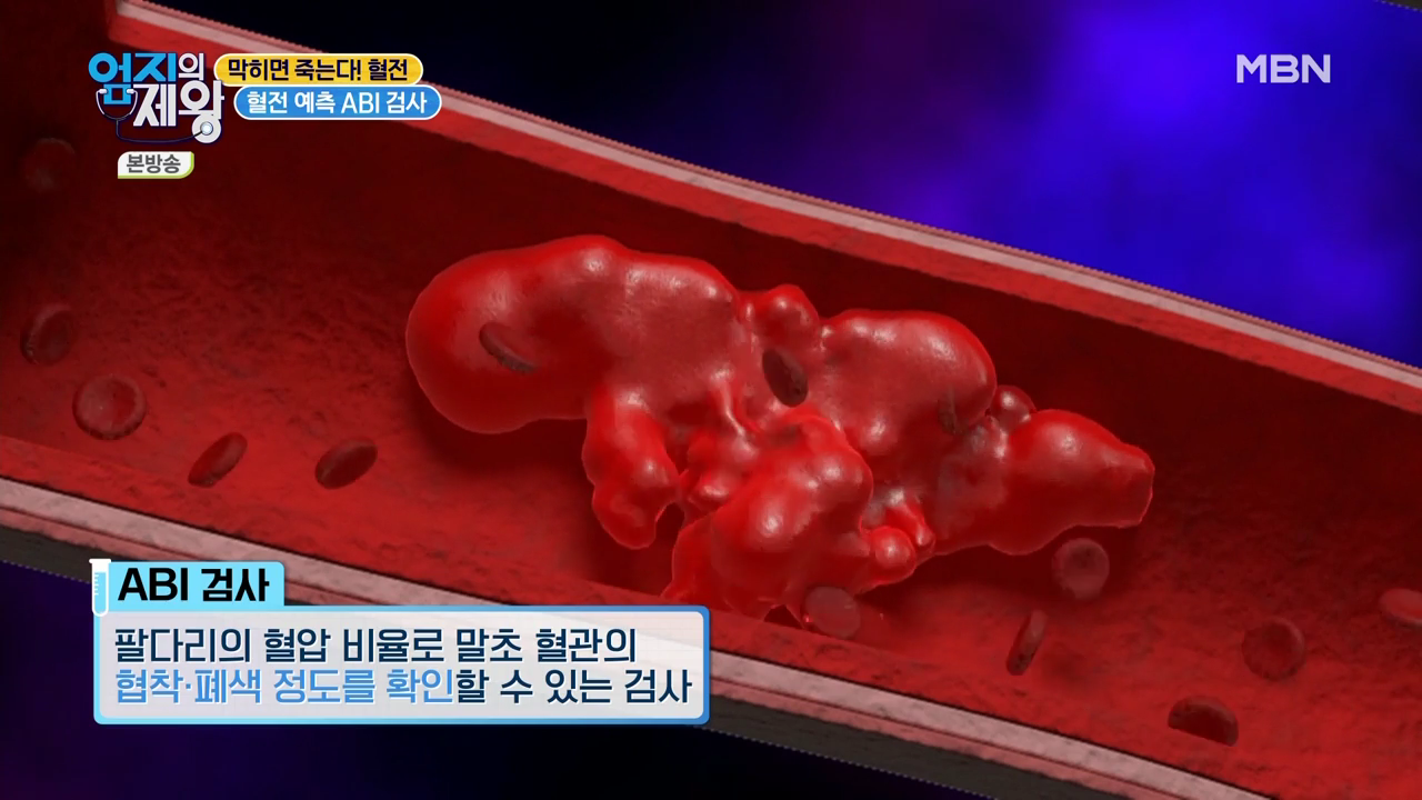 엄지의 제왕 415회 혈전편 본방영상.mp4_001448447.png